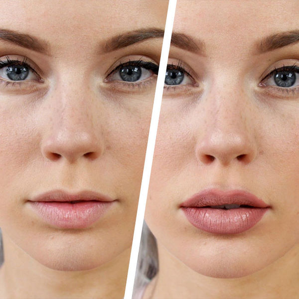 Как выглядят губы после увеличения? Реальные фото до и после! | Красота и уход | Дзен